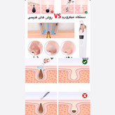 میکرودرم خانگی با فیلتر و سری میکرو کریستال Multi functional instrument HY9