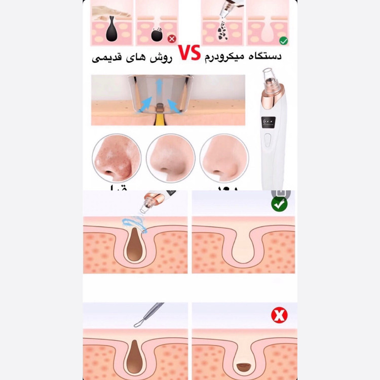 میکرودرم خانگی با فیلتر و سری میکرو کریستال Multi functional instrument HY9